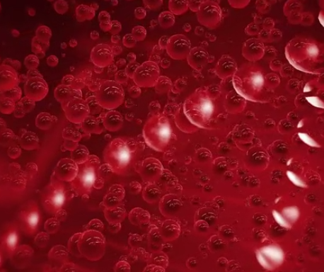 Beta Thalassemia